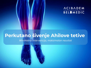 Perkutano šivenje Ahilove tetive