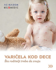 Varičela kod dece - šta roditelji treba da znaju