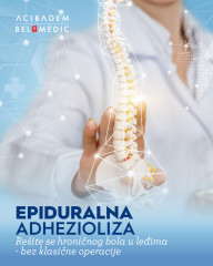Epiduralna adhezioliza: savremeno rešenje za hronični bol u leđima